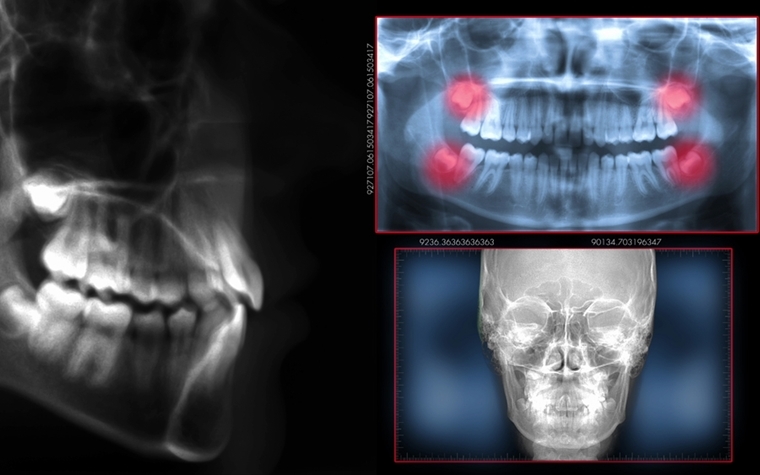 Virtual Radiography Information Session on March 21