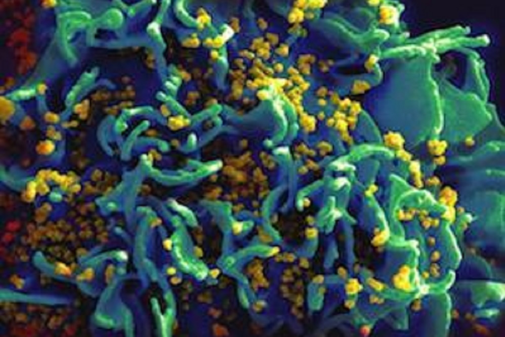 Vital Signs: Progress Toward Eliminating HIV as a Global Public Health Threat
