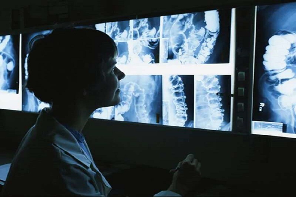 Member Response Vital to Accuracy of ACR/RBMA Radiology Workforce Survey