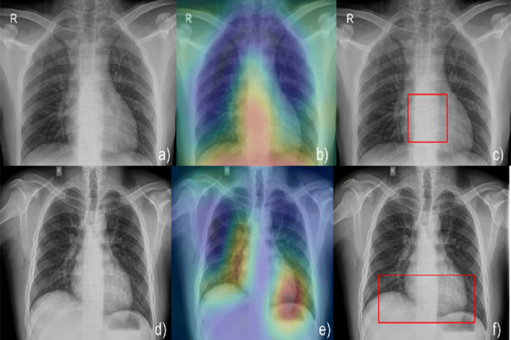 New X-ray System Brings Artificial Intelligence to Local Imaging New X-ray System Brings Artificial Intelligence to Local Imaging