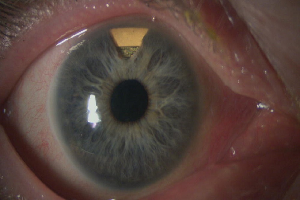 ATRIUM HEALTH NAVICENT: Protect Your Eyes This Summer with Safety Tips from Atrium Health Navicent