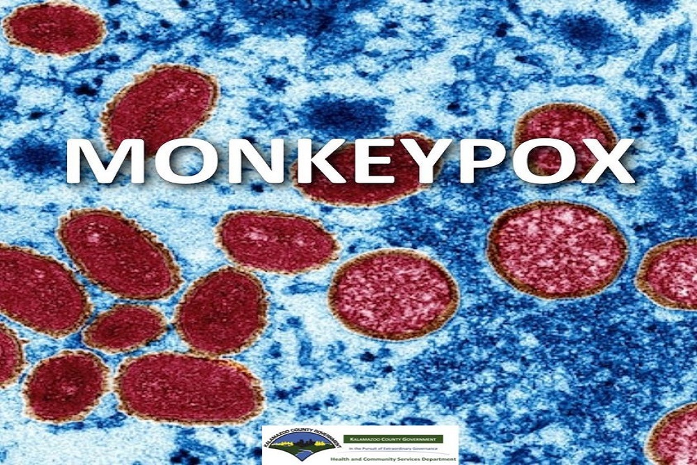 Monkeypox is a rare viral infection