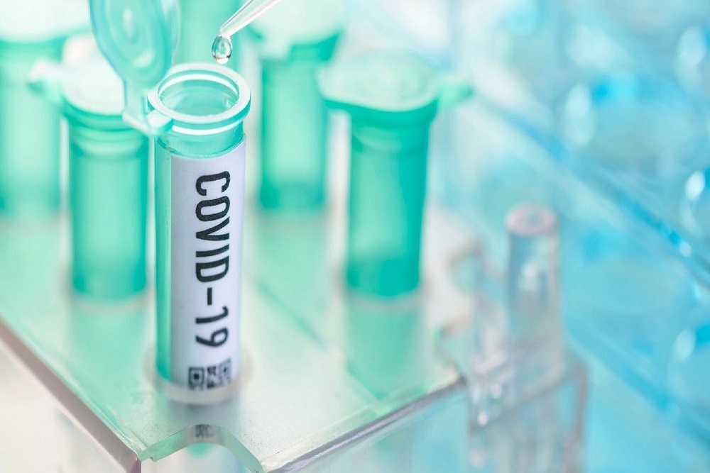 THE NAVAJO NATION: HEHSC hears Navajo Nation Testing Coordination Team report on COVID-19 testing strategies and gating measures THE NAVAJO NATION: HEHSC hears Navajo Nation Testing Coordination Team report on COVID-19 testing strategies and gating measures