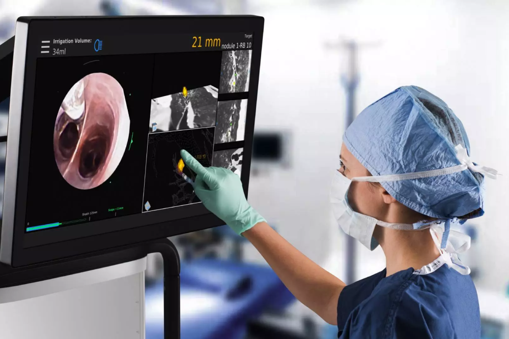 Bon Secours Using New Technology for Lung Cancer Diagnosis