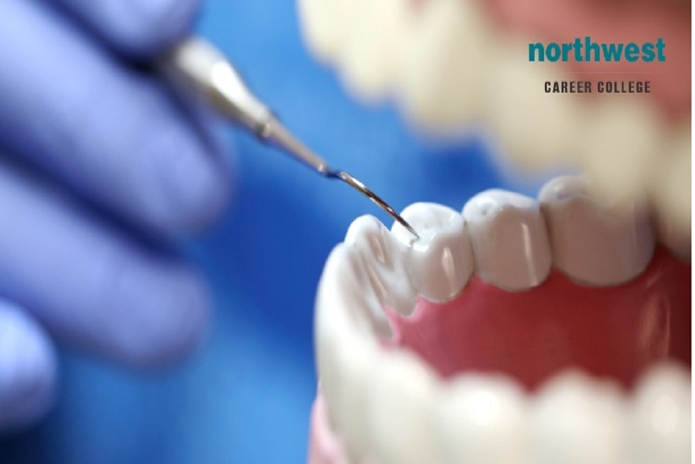 NORTHWEST CAREER COLLEGE: The Five Main Benefits of Training as a Dental Assistant