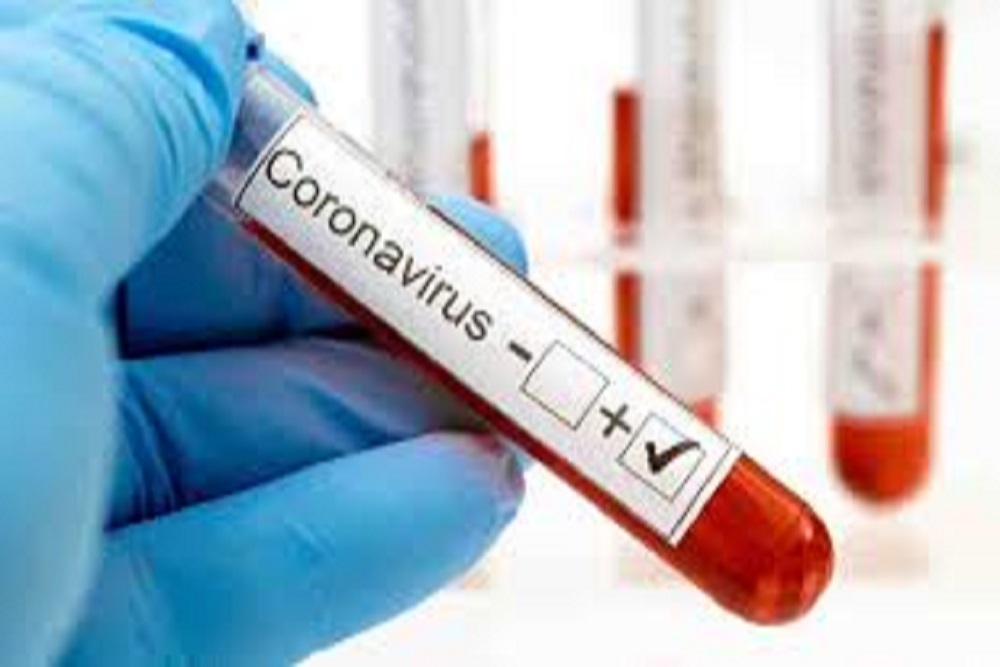 MCDOWELL COUNTY HEALTH DEPARTMENT: 10 Additional McDowell County Residents Have Tested Positive For Novel Coronavirus MCDOWELL COUNTY HEALTH DEPARTMENT: 10 Additional McDowell County Residents Have Tested Positive For Novel Coronavirus