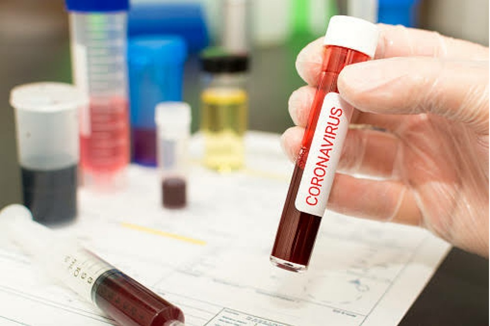 CDC tally of provisional coronavirus deaths in Arizona is 26