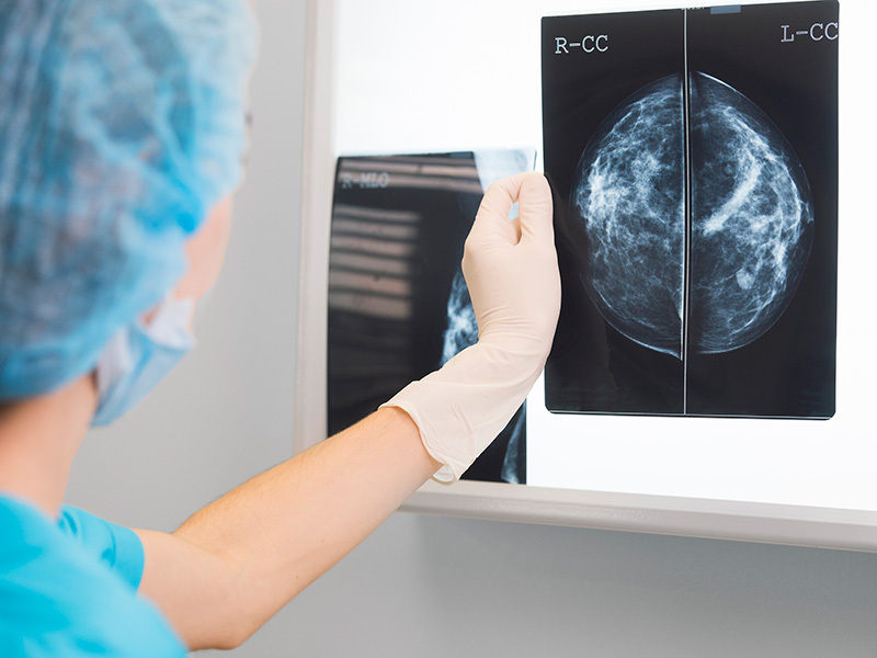 Study finds why immunotherapies don’t work on hardest-to-treat breast cancers Study finds why immunotherapies don’t work on hardest-to-treat breast cancers