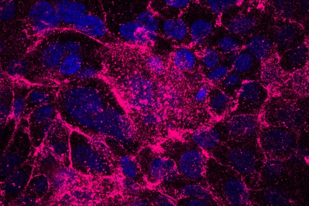 Cancer Screenings: Which Tests to Get and When