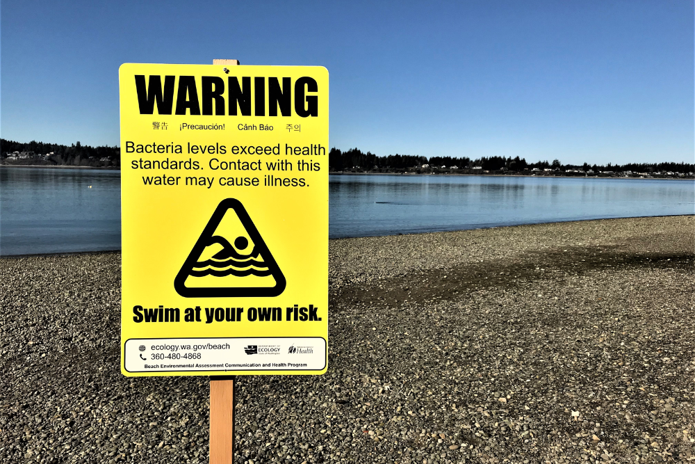 Fecal Matters: No-contact advisory issued for Silverdale Waterfront Park and Lions Field Park, Kitsap County