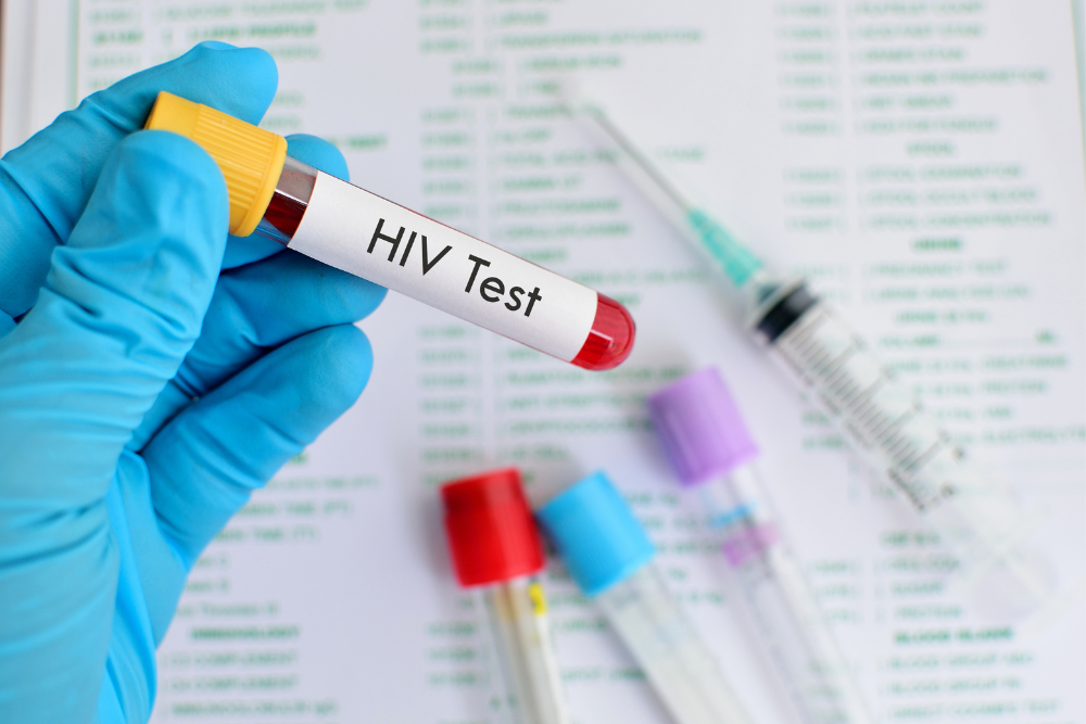 Alexandria Health Department Hosts National HIV Testing Day Event