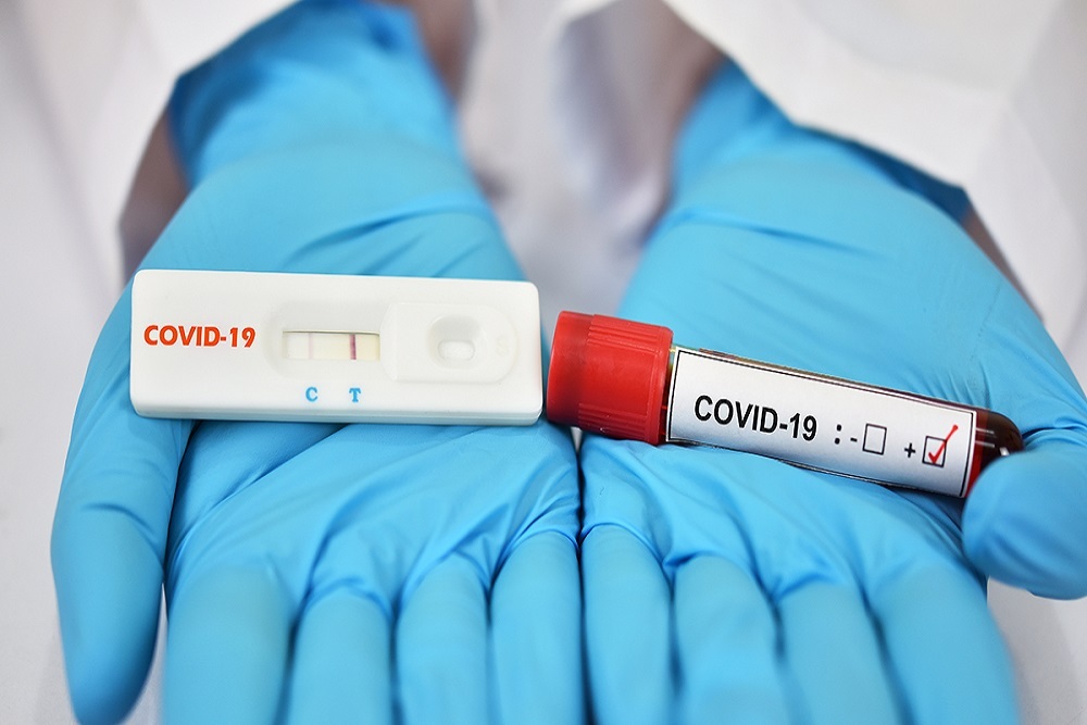 The City of Detroit now offers COVID-19 Test to Treat program