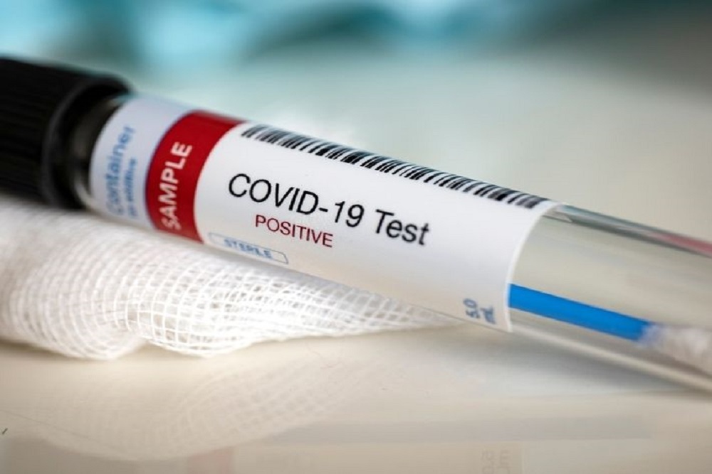 CITY OF WASHINGTON: COVID-19 PCR Testing Location CITY OF WASHINGTON: COVID-19 PCR Testing Location