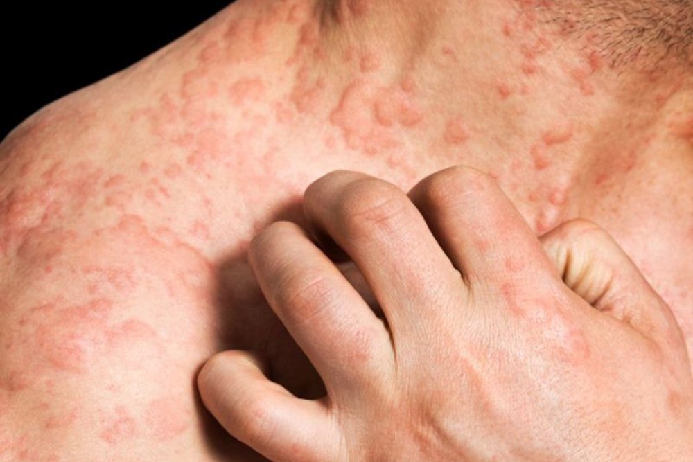 Are skin conditions more than skin deep?